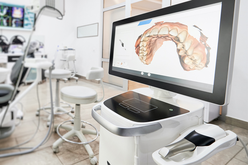 Intra-Oral Scanner in Manchester